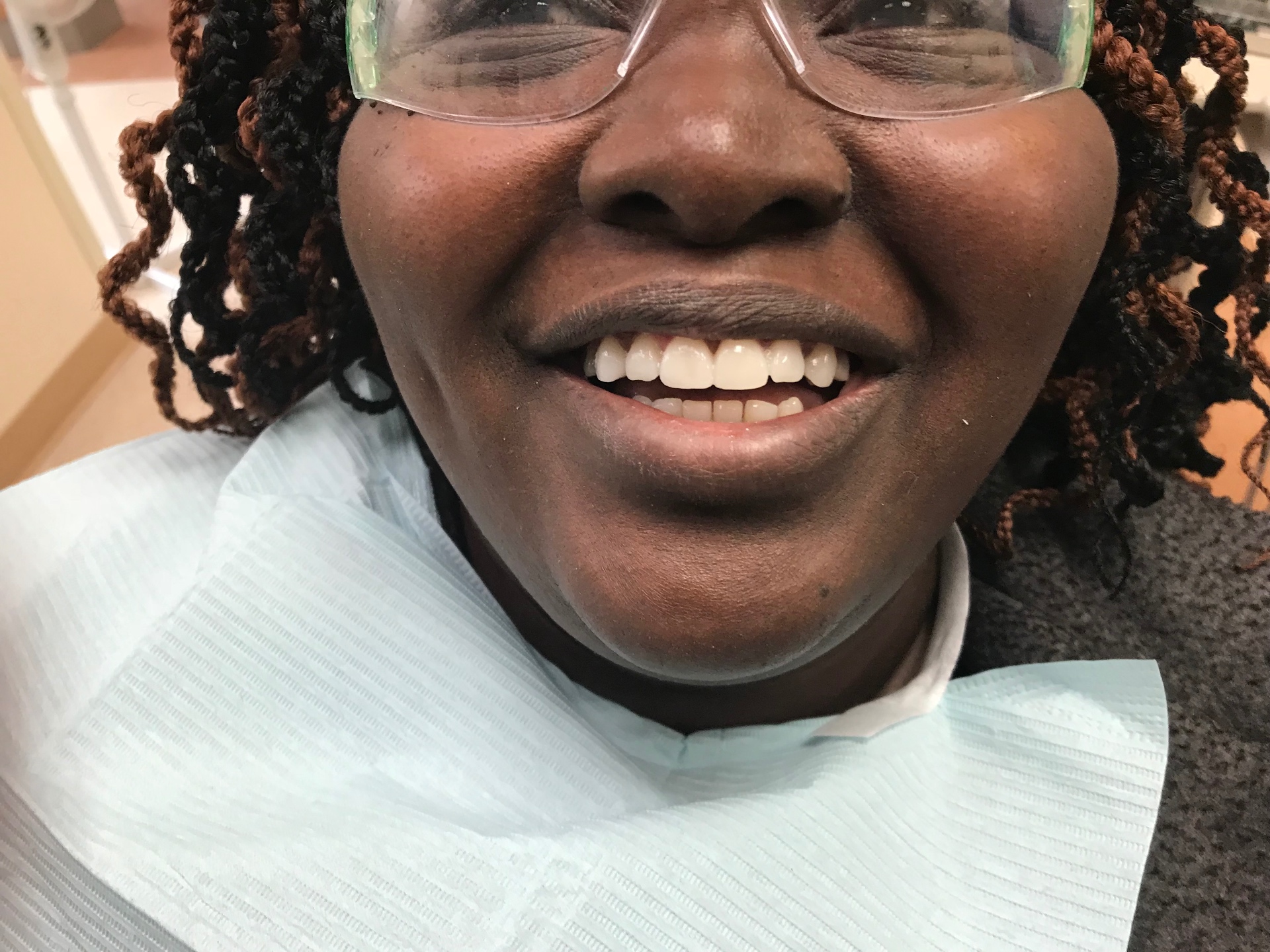 A more balanced smile — after